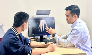 Kỳ tích: Lần đầu tiên tại Việt Nam, vi phẫu thuật thành công cứu sống ngón tay thủy thủ bị đứt rời sau 25 giờ